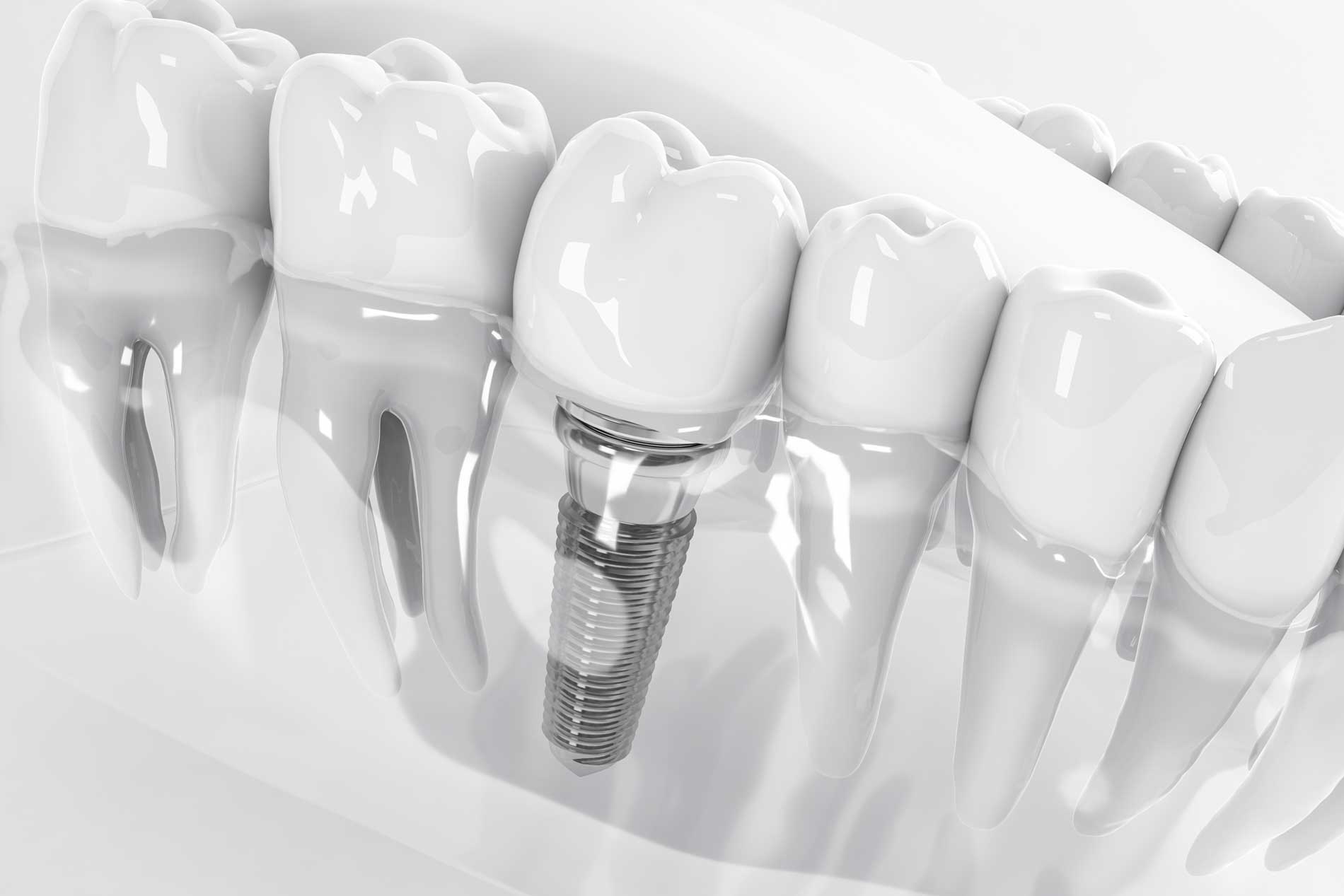 Dental Lab in Clinton Township, MI